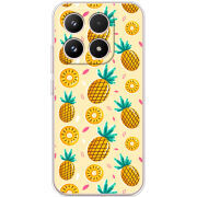 Чохол BoxFace Xiaomi 17 