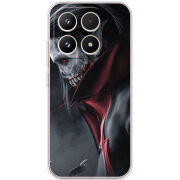 Чохол BoxFace Xiaomi 17 