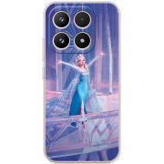 Чохол BoxFace Xiaomi 17 