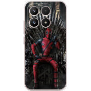 Чохол BoxFace Xiaomi 17 