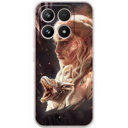 Чохол BoxFace Xiaomi 17 