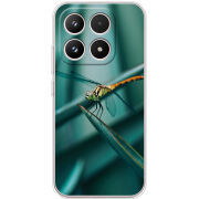 Чохол BoxFace Xiaomi 17 