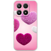 Чохол BoxFace Xiaomi 17 