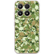 Чохол BoxFace Xiaomi 17 