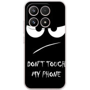 Чохол BoxFace Xiaomi 17 Don't Touch my Phone