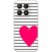 Чохол BoxFace Xiaomi 17 