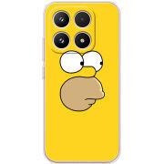 Чохол BoxFace Xiaomi 17 