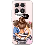 Прозорий чохол BoxFace Xiaomi 17 Super Mama