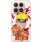Прозорий чохол BoxFace Xiaomi 17 Naruto