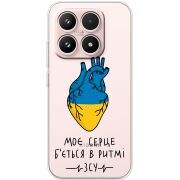 Прозорий чохол BoxFace Xiaomi 17 Моє серце в ритмі ЗСУ