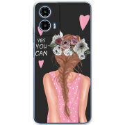 Чохол BoxFace Motorola Moto G35 You Can