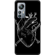 Чохол BoxFace Blackview A85 