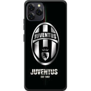 Чохол BoxFace Blackview A95 