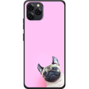 Чохол BoxFace Blackview A95 