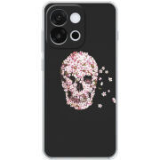 Чохол BoxFace OnePlus 13T 