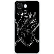 Чохол BoxFace OnePlus 13T 