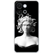 Чохол BoxFace OnePlus 13T 