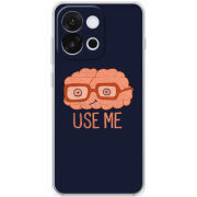 Чохол BoxFace OnePlus 13T 