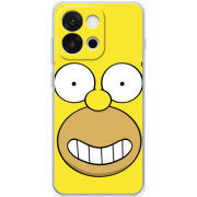 Чохол BoxFace OnePlus 13T 