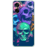 Чохол BoxFace OnePlus Ace 5 Racing 