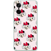 Чохол BoxFace OnePlus Ace 5 Racing 