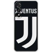 Чохол BoxFace OnePlus Ace 5 Ultra FC J