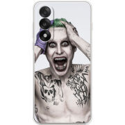 Чохол BoxFace OnePlus Ace 5 Ultra 