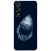 Чохол BoxFace OnePlus Ace 5 Ultra 