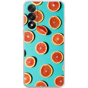 Чохол BoxFace OnePlus Ace 5 Ultra 