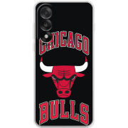 Чохол BoxFace OnePlus Ace 5 Ultra 