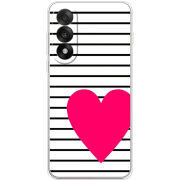 Чохол BoxFace OnePlus Ace 5 Ultra 