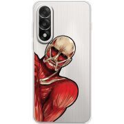 Прозорий чохол BoxFace OnePlus Ace 5 Ultra Титан