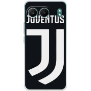 Чохол BoxFace OnePlus Nord 4 FC J