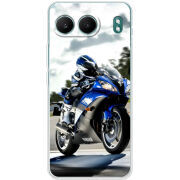 Чохол BoxFace OnePlus Nord 4 