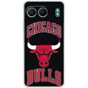 Чохол BoxFace OnePlus Nord 4 