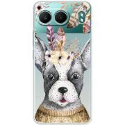 Прозорий чохол BoxFace OnePlus Nord 4 