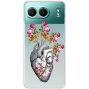 Чохол зі стразами OnePlus Nord 4 Heart