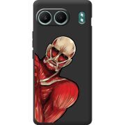 Чорний чохол BoxFace OnePlus Nord 4 Титан