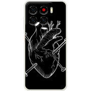 Чохол BoxFace ZTE Blade A56 