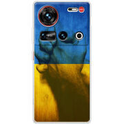 Чохол BoxFace Nubia Z70 Ultra Handshake