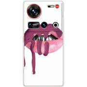 Чохол BoxFace Nubia Z70 Ultra 