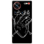 Чохол BoxFace Nubia Z70 Ultra 