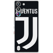 Чохол BoxFace Nubia RedMagic 10 Pro FC J