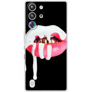 Чохол BoxFace Nubia RedMagic 10 Pro 