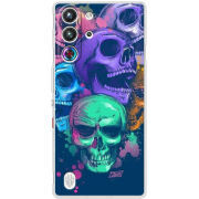 Чохол BoxFace Nubia RedMagic 10 Pro 