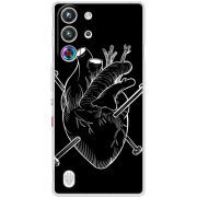 Чохол BoxFace Nubia RedMagic 10 Pro 