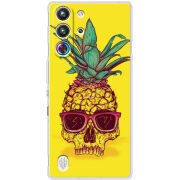 Чохол BoxFace Nubia RedMagic 10 Pro Pineapple Skull