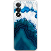 Чохол BoxFace OnePlus Nord 5 