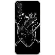 Чохол BoxFace OnePlus Nord 5 