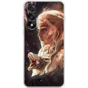 Чохол BoxFace OnePlus Nord 5 